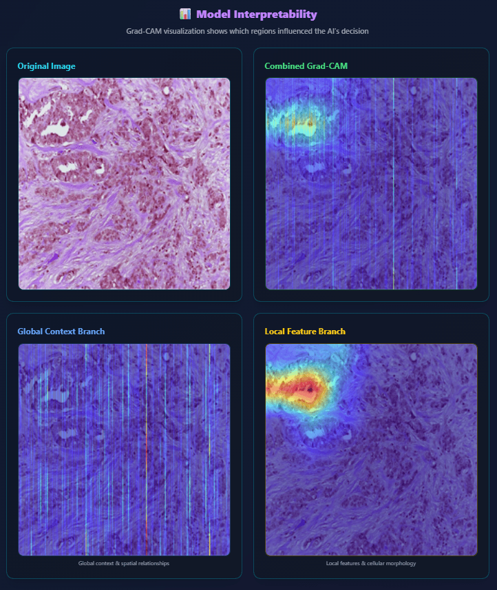 Analysis screen from the DeepCancer research prototype showing a histopathology image and Grad-CAM focus maps together.